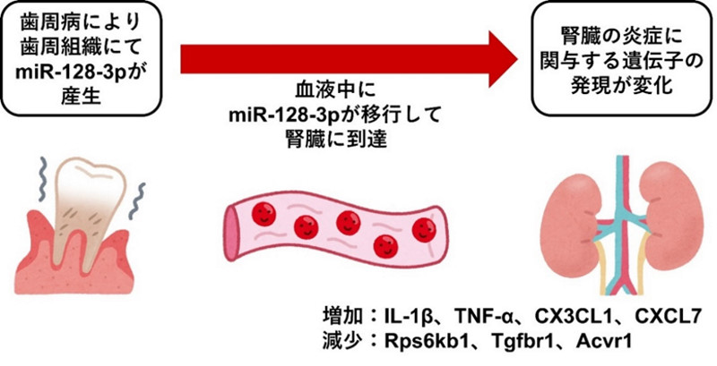 【歯】歯周病が腎臓の炎症を引き起こすメカニズムを動物実験で解明