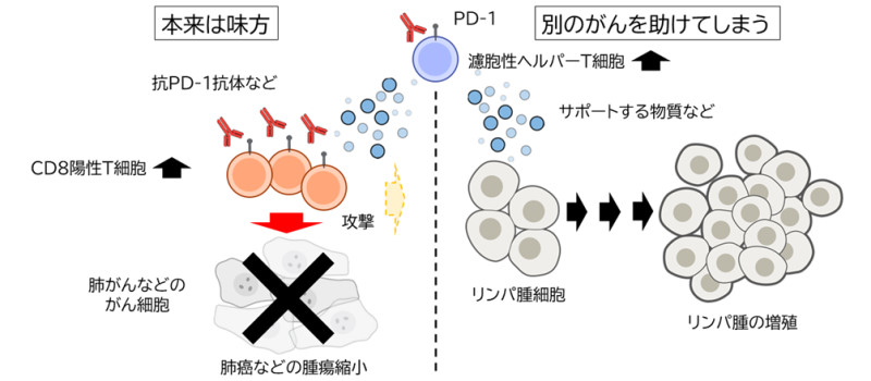 【医】がん免疫療法使用中に隠れていたリンパ腫が見つかる場合がある